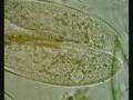 File:Paramecium caudatum conjugation.ogv