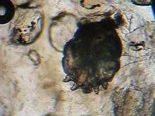 Video of the Sarcoptes scabiei mite