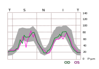 TSNIT graph