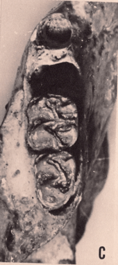 Two teeth in a bone, with two large openings before the front tooth