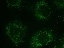 Peroxisome in rat neonatal cardiomyocyte staining The SelectFX Alexa Fluor 488 Peroxisome Labeling Kit directed against peroxisomal membrane protein 70 (PMP 70)